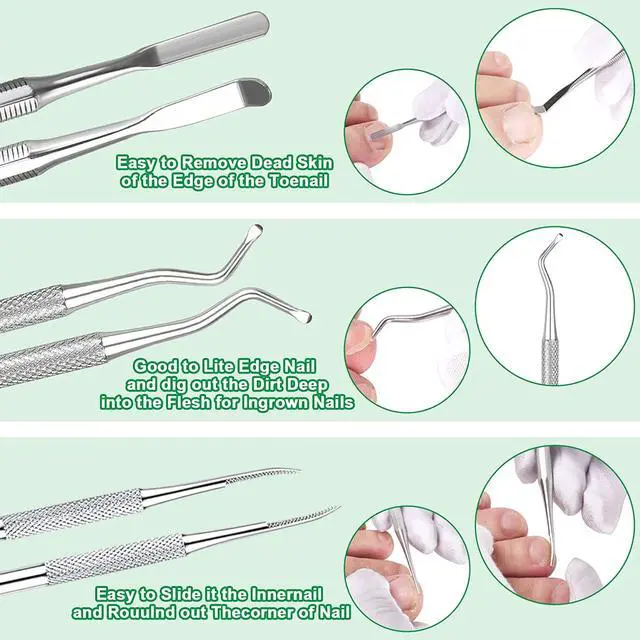 Alt view image 4 of 7 - 6-Pack Ingrown Toenail File and Lifters, Professional Surgical Stainless Steel Ingrown Toenail Removal Tool Kit, Manicure Treatment Pedicure Tools for Feet Under Nail Cleaner Correction Polish Pain