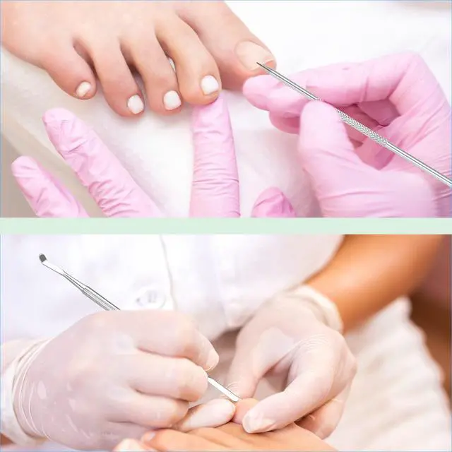 Alt view image 7 of 7 - 6-Pack Ingrown Toenail File and Lifters, Professional Surgical Stainless Steel Ingrown Toenail Removal Tool Kit, Manicure Treatment Pedicure Tools for Feet Under Nail Cleaner Correction Polish Pain