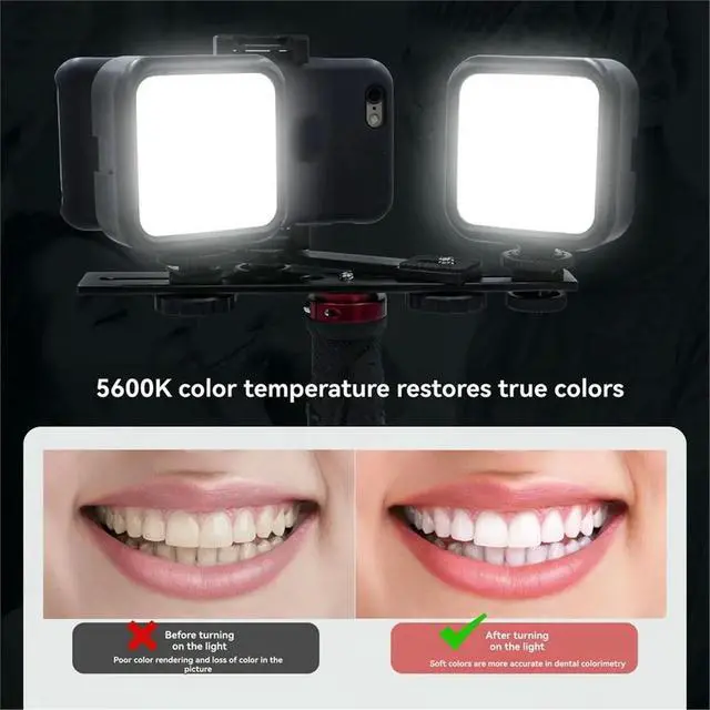 Alt view image 2 of 3 - Dental Phone Photography Light Professional Lighting for Mobile Videos and Photos-Dentists' Camera with Wide-Angle Lens