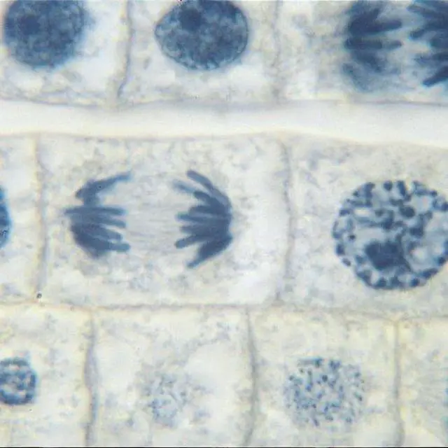 Main image of Fish and Onion Mitosis Microscope Slide and Study Guide Set