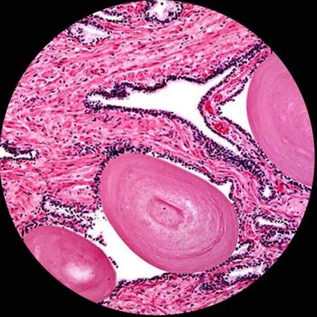 Alt view image 4 of 4 - M150 Compound Monocular Microscope, WF10x Eyepiece, 400X | 40X-400X Magnification Range Compound Biological Microscope Built-In LED Illumination Brightfield Imaging Built-In