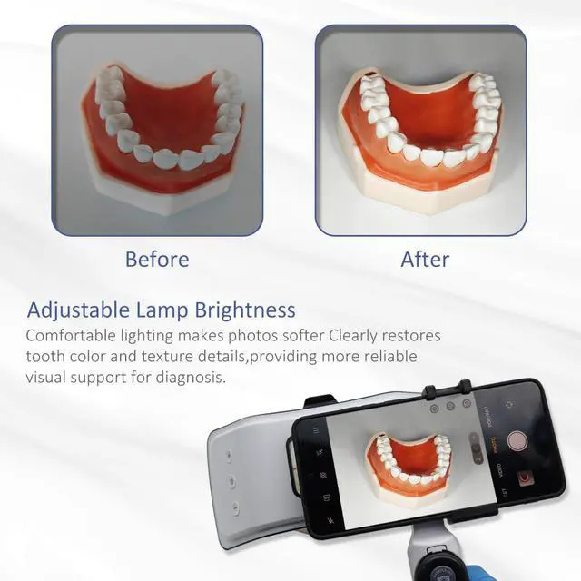 Alt view image 3 of 7 - Dental LED Photography Light Kit CRI95 Polarizing Fill Light Bluetooth Remote Phone Teeth Cosmetic Shoot