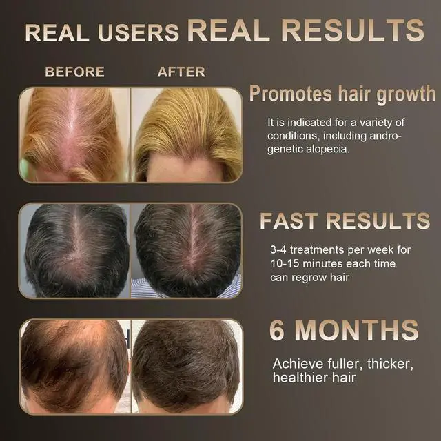 Alt view image 5 of 7 - Laser Hair Growth Comb, 650nm Red Light Therapy, White