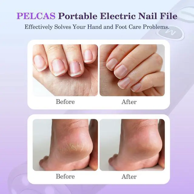 Alt view image 2 of 7 - Electric Nail Drills, 10 Speeds Cordless Nail File with LED Light