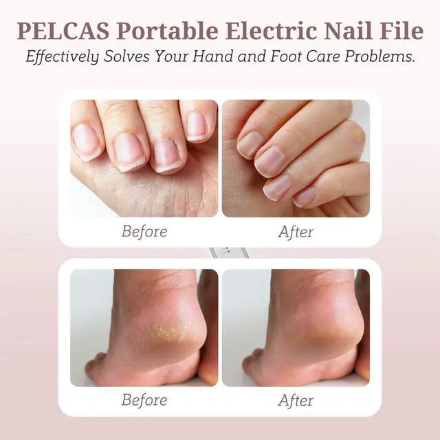 Alt view image 2 of 7 - Electric Nail File, 5 Speeds Nail Grinder for Thick Toenails