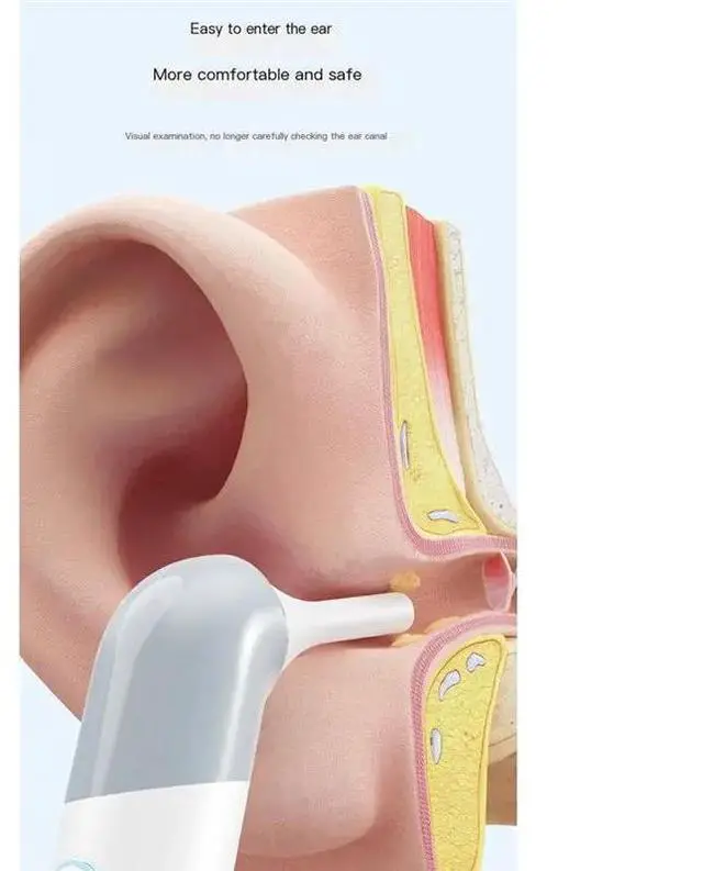 Alt view image 3 of 3 - 1080P Endoscope Ear Camera With 4 LED Lights 10 Colorful Accessories- For Ear, Nose, Skin Care