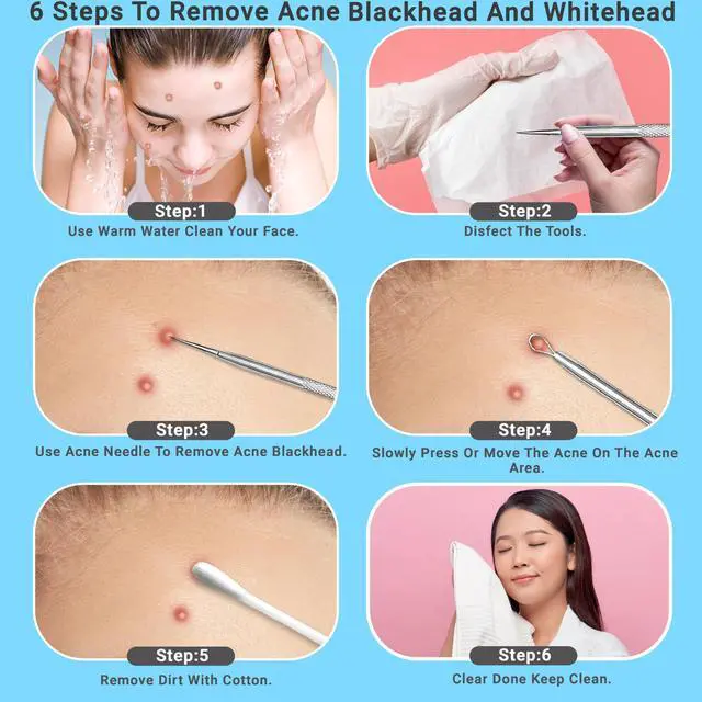 Alt view image 5 of 7 - 2Pcs Stainless Steel Surgical Pimple Extractor Acne Tool Blackhead Remover