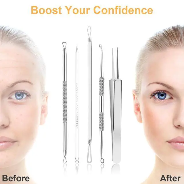 Alt view image 4 of 7 - 9Pcs Blackhead Remover Tools, Pimple Popper Tool Kit, Pimple Extractor