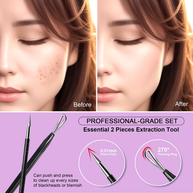 Alt view image 4 of 7 - Teenitor 2-in-1 Pimple Extractor Comedone Acne Tool for Face and Nose Blackhead Removal