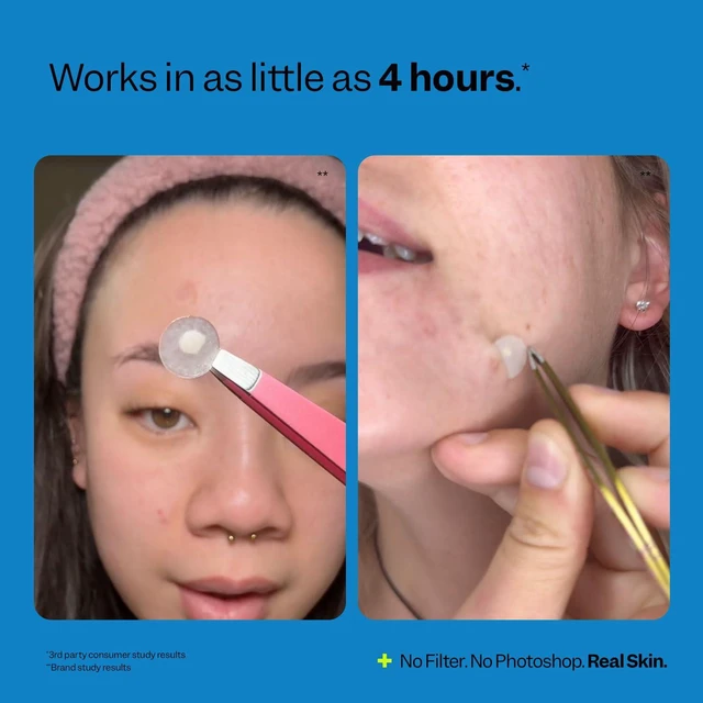 Alt view image 6 of 6 - Peach Slices Acne Spot Dots 30ct Hydrocolloid Pimple Patches for Face, 3 Sizes (7, 10, 12mm), Vegan, Cruelty Free, Korean Skin Care & Beauty