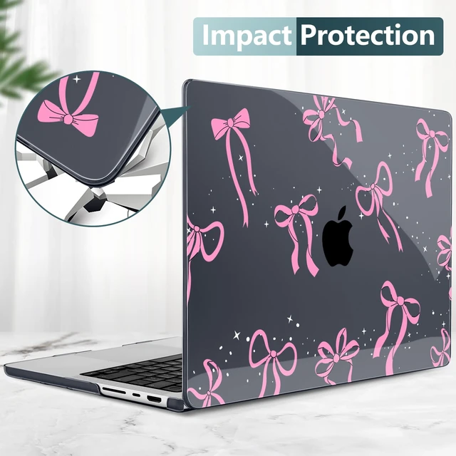 Alt view image 5 of 5 - DONGKE Case for MacBook Pro 14 Inch (2026-2021 Release, M5 M4 M3 M2 M1 Pro/Max Chip), Plastic Slim Hard Shell Protective Cover with Keyboard Cover & Screen Protector, Bows & Stars