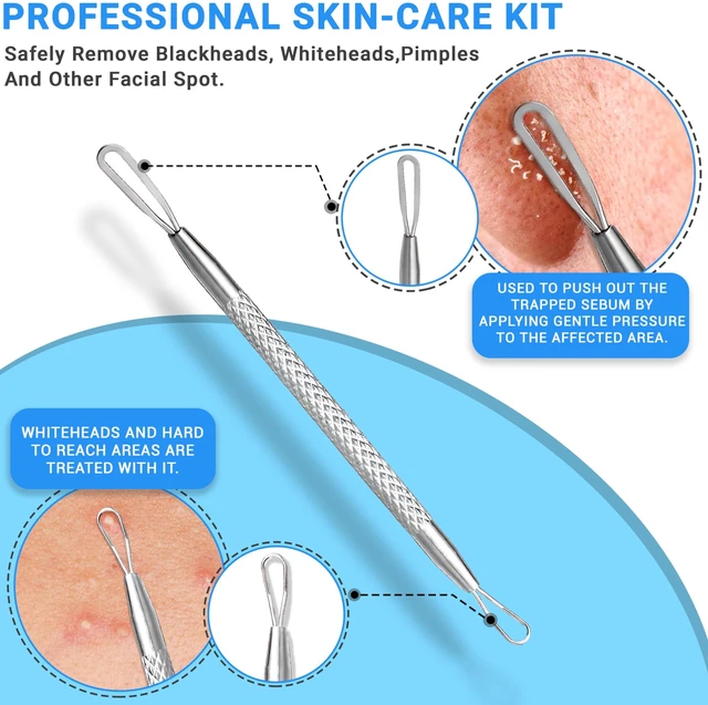 Alt view image 6 of 7 - 2Pcs Stainless Steel Pimple Extractor Blackhead Remover Acne Tool Surgical