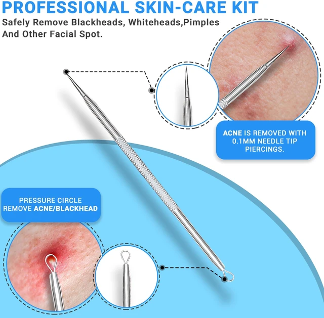 Alt view image 4 of 7 - 2Pcs Stainless Steel Pimple Extractor Blackhead Remover Acne Tool Surgical