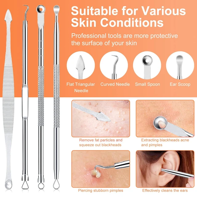 Alt view image 3 of 7 - IUMAKEVP 15-Piece Professional Stainless Steel Blackhead Remover Comedone Extractor Tool Kit with Metal Case (Silver)