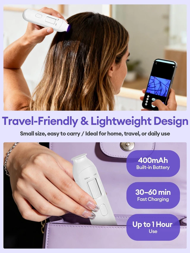 Alt view image 3 of 7 - Wireless Scalp Camera Handheld Microscope,50X200X Zoom Fixed Focus HD Magnifier with LED,Portable Microscopes for Phone/ipad,Designed for Casual Scalp and Hair Surface Viewing