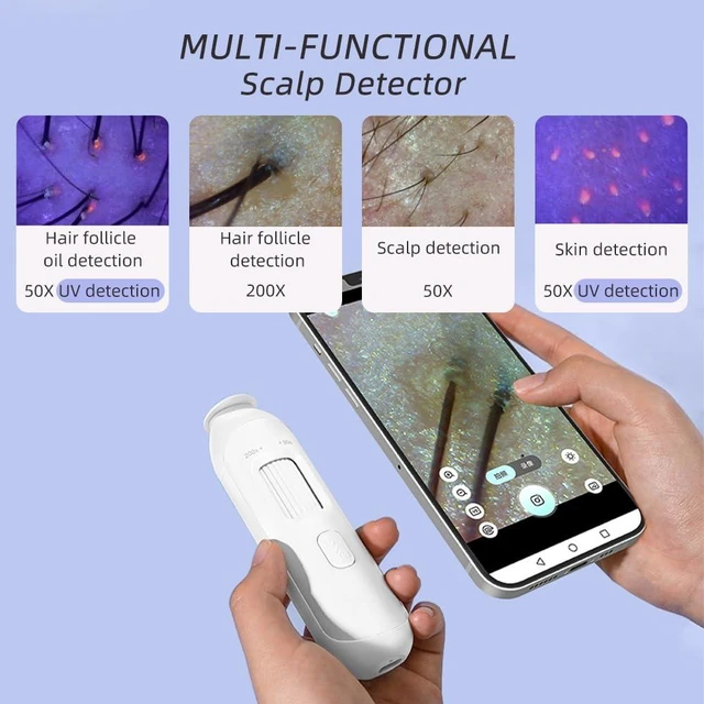Alt view image 7 of 7 - Wireless Scalp Camera Handheld Microscope,50X200X Zoom Fixed Focus HD Magnifier with LED,Portable Microscopes for Phone/ipad,Designed for Casual Scalp and Hair Surface Viewing