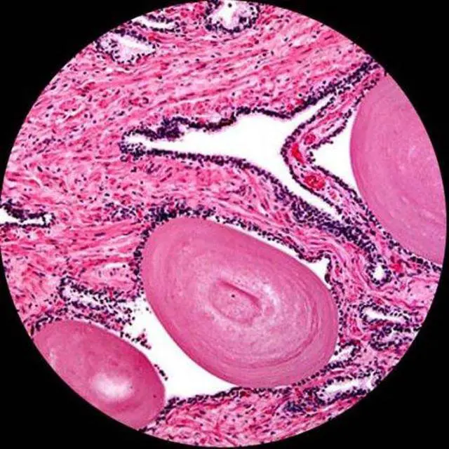 Alt view image 6 of 6 - M500B-LED Cordless Monocular Compound Microscope, WF10x and WF20x | 40X-2000X Magnification Range Compound Biological Microscope Cordless Battery Powered Built-In LED Illumination