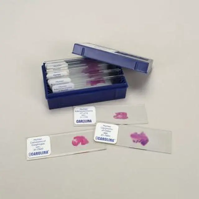 Alt view image 2 of 2 - Malignant Tissues Microscope Slide Set