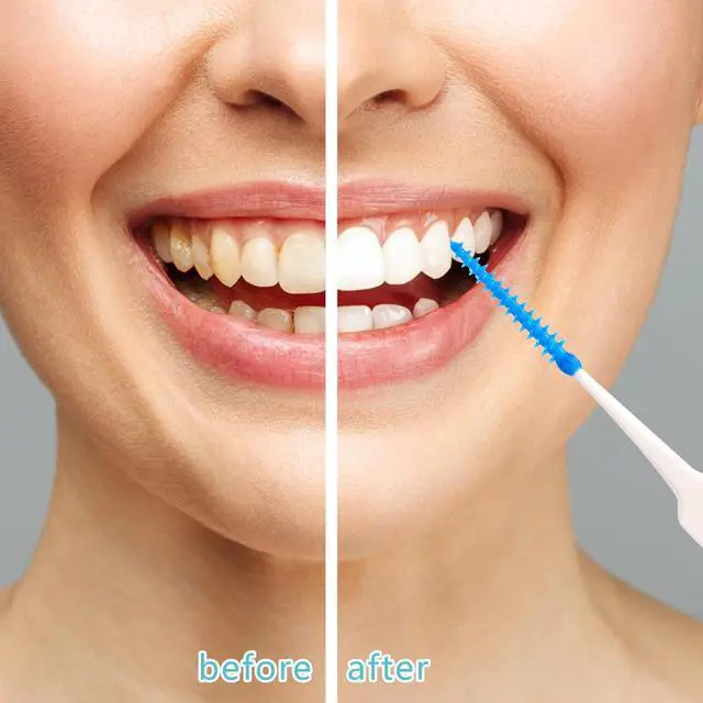 Alt view image 6 of 7 - 220 Interdental Brushes, Silicone Dental Picks with Case, Blue
