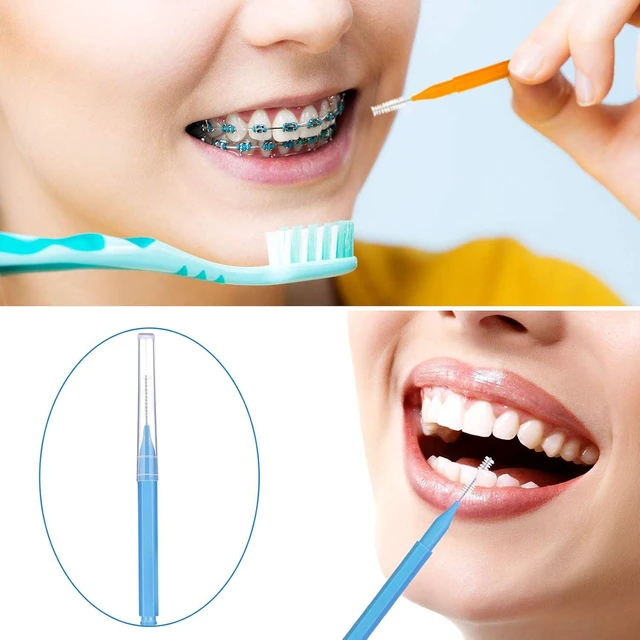 Alt view image 5 of 7 - Patelai 100 Pcs Braces Dental Brushes,Bright Colors,Multiple Sizes
