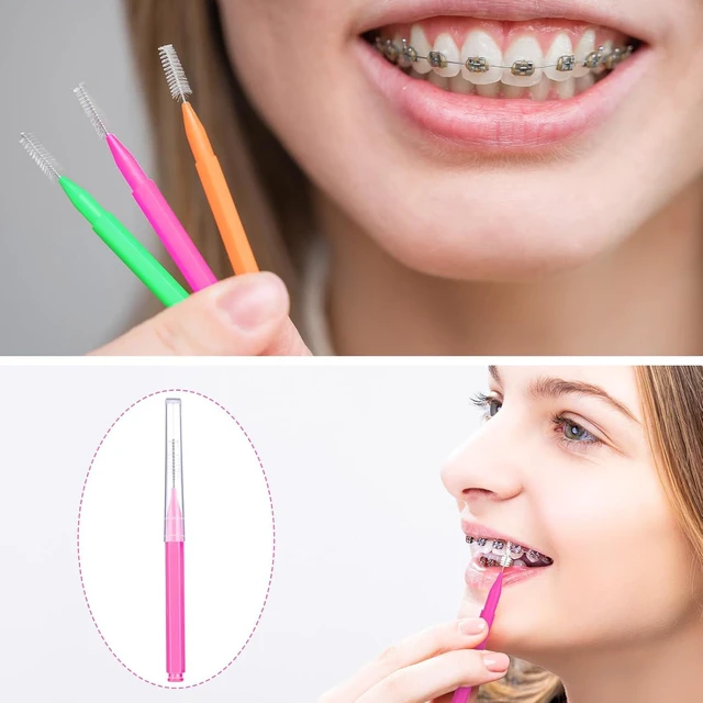 Alt view image 6 of 7 - Patelai 100 Pcs Braces Dental Brushes,Bright Colors,Multiple Sizes