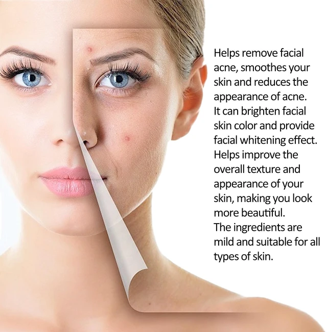 Alt view image 4 of 6 - Tea Tree Acne Essence Gentle Facial Pore Cleansing Skin Care Serum