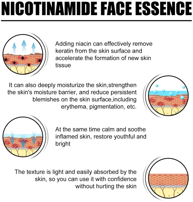 Alt view image 3 of 6 - and Skin Brightening, Pore Minimization, Moisturizing, Hydration, Niacinamide Facial Serum for Acne Scar Removal