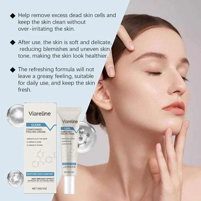Alt view image 3 of 6 - Acne Care Exfoliating Moisturizer Gentle Deep Cleansing Hydrating Skin Brightening Natural Radiance
