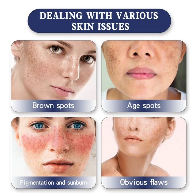 Alt view image 3 of 6 - Tender and Even Tone, Moisturizing & Revitalizing Formula for Soft, Skin Brightening Cream for Dark Spot Reduction