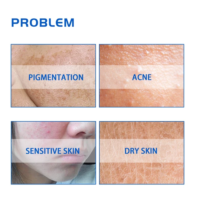 Alt view image 4 of 7 - Anti-Aging & Hydrating Skin Care Essence, Blueberry Extract Facial Brightening Cream - Deep Cleansing