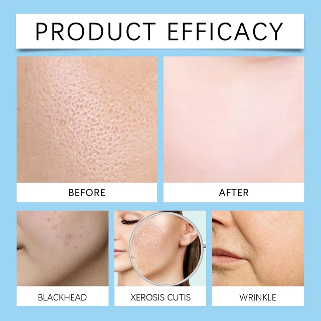 Alt view image 3 of 6 - Deep Moisturizing & Radiance Boosting, Hyaluronic Acid Roller Serum for Pore Refining