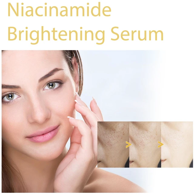 Alt view image 4 of 6 - Hydrates and Moisturizes for Facial Care, Whitens Skin, HOYGI Niacinamide Brightening Essence - Diminishes Dark Spots & Fine Lines