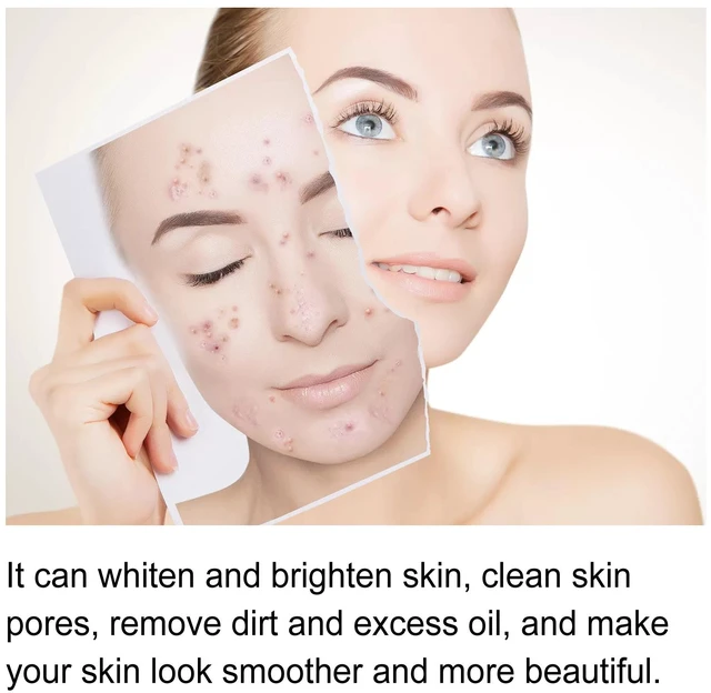 Alt view image 3 of 6 - Hydrating and Brightening Essence, Papaya Purifying & Radiance Boosting Essential Oil for Acne-Prone Skin Repair