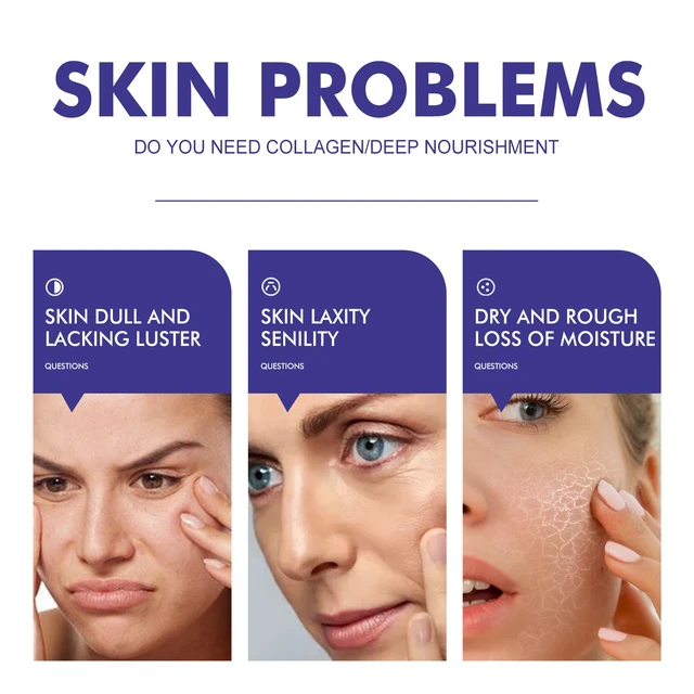 Alt view image 3 of 6 - Hydrating & Smoothing Skin, Firming, WIYUN Collagen Face Cream for Brightening
