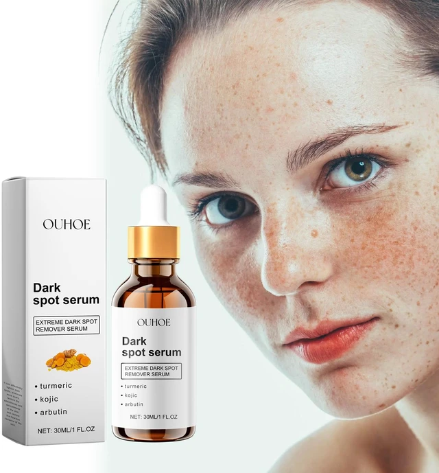 Alt view image 2 of 6 - Radiance Serum Hydrating Tightening Face Skin Revitalization for Dull Complexion Brightening Treatment