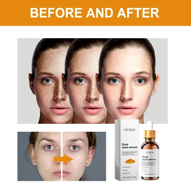 Alt view image 4 of 6 - Radiance Serum Hydrating Tightening Face Skin Revitalization for Dull Complexion Brightening Treatment