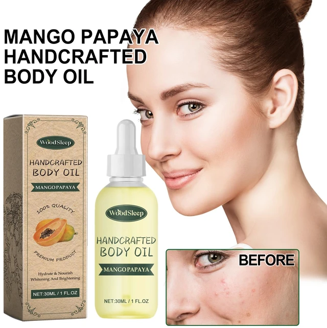 Alt view image 2 of 6 - Hydrating and Brightening Essence, Papaya Purifying & Radiance Boosting Essential Oil for Acne-Prone Skin Repair