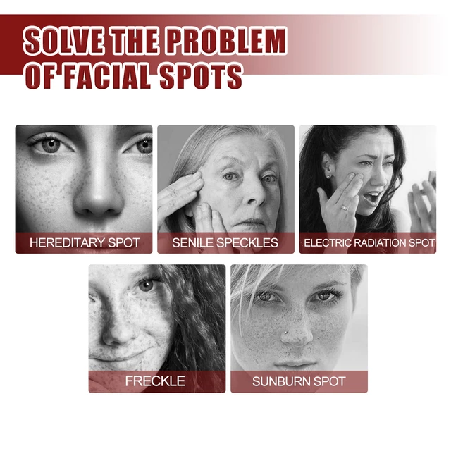 Alt view image 3 of 6 - Hydrating Face Care for Dark Spots & Uneven Tone, Skin Brightening Cream