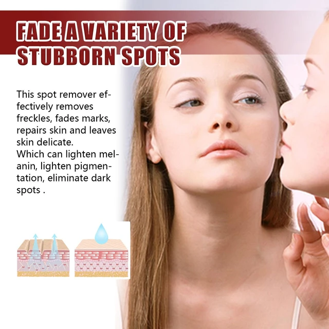 Alt view image 4 of 6 - Hydrating Face Care for Dark Spots & Uneven Tone, Skin Brightening Cream