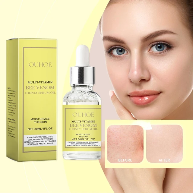 Alt view image 2 of 6 - Honey Essence Oil Hydrating Skin Care Serum for Radiant Vitality and Refreshing Moisture