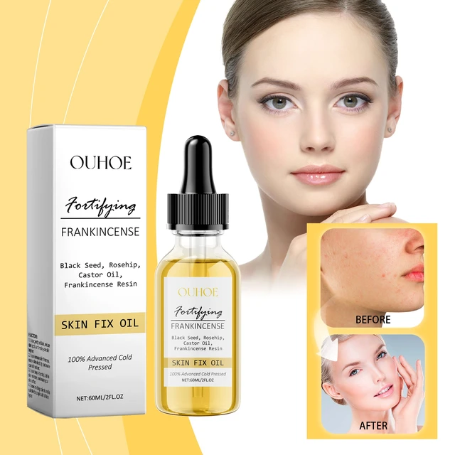 Alt view image 2 of 6 - Hydrating Facial Essence Gentle Skin Tightening Softening Brightening Moisture Care