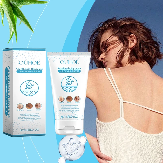 Alt view image 2 of 6 - Hydrating & Rejuvenating Non-Greasy Formula for Elbow and Neck Dark Spots, Black Spinous Skin Lightening Cream - Moisturizing