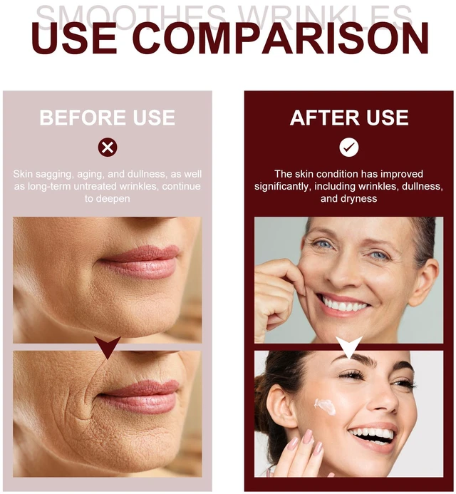 Alt view image 4 of 6 - Repair Formula, Reduces Fine Lines, Retinol Firming Cream - Lifting & Tightening Facial Skin
