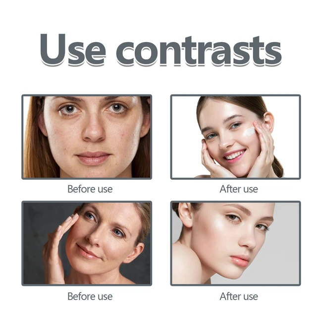 Alt view image 4 of 6 - Softening & Fine Line Reduction - Daily Skincare Moisturizer, Gentle Facial Cream for Hydration