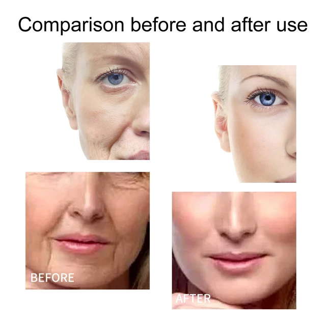 Alt view image 4 of 6 - Daily Deep Hydrating Collagen Essence for Facial Nourishment & Moisturizing