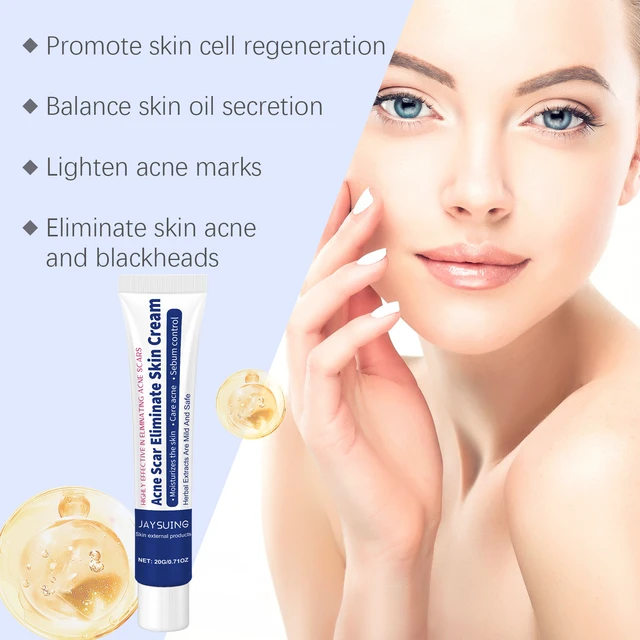 Alt view image 3 of 6 - Herbal Acne Wash Cream Face Refreshing Oil Control Gentle Cleansing Skin Pores Softening Skincare Cream