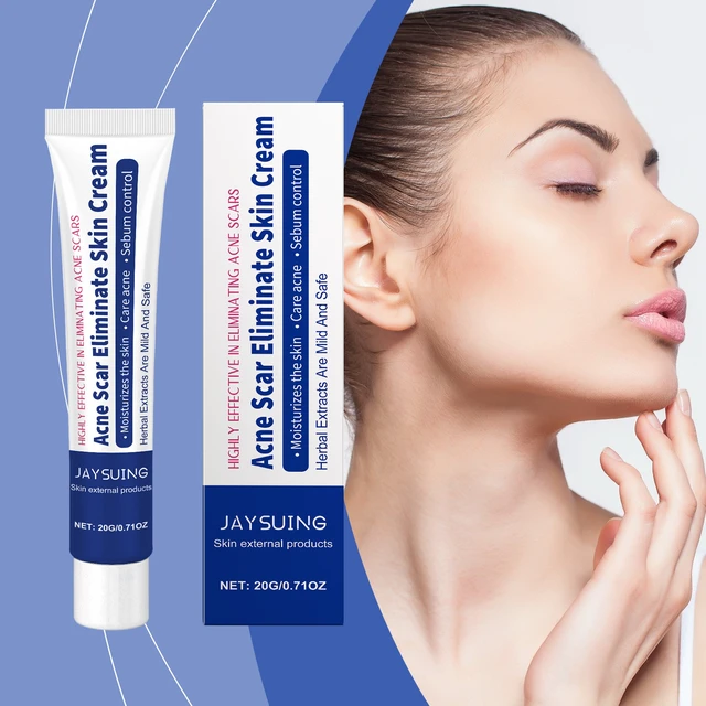 Alt view image 2 of 6 - Herbal Acne Wash Cream Face Refreshing Oil Control Gentle Cleansing Skin Pores Softening Skincare Cream