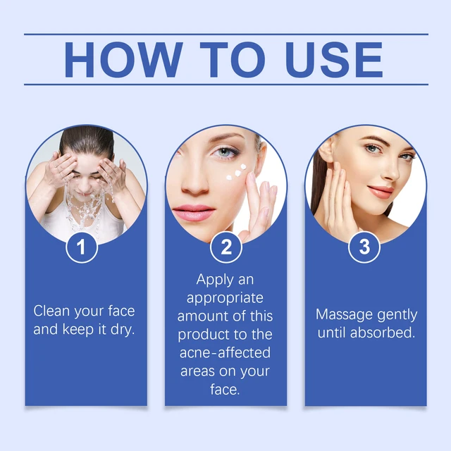 Alt view image 6 of 6 - Herbal Acne Wash Cream Face Refreshing Oil Control Gentle Cleansing Skin Pores Softening Skincare Cream
