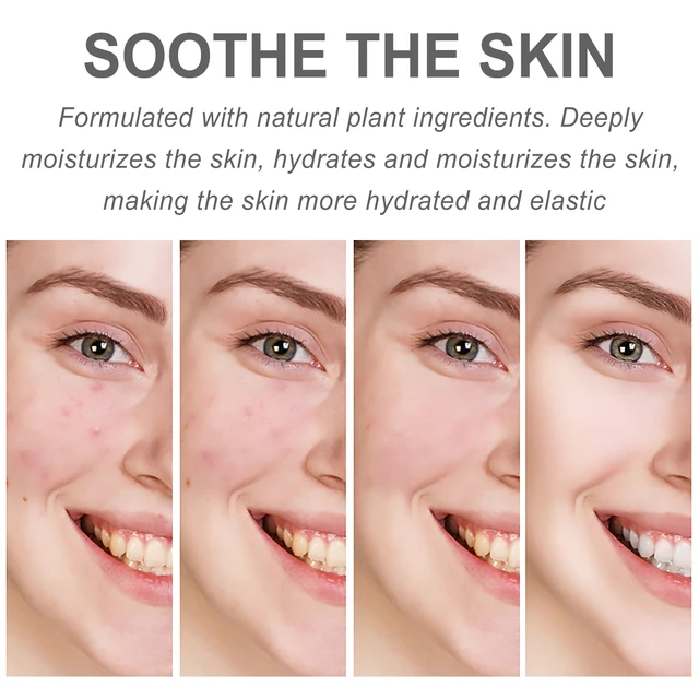 Alt view image 3 of 6 - Firming & Reducing Fine Lines, West Month Centella Asiatica Hydrating Cream for Brightening