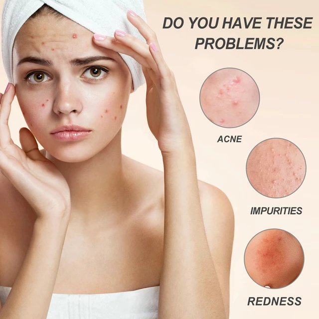 Alt view image 4 of 6 - Firming & Reducing Fine Lines, West Month Centella Asiatica Hydrating Cream for Brightening